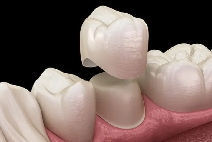 Estetska stomatologija podrazumeva jedan veći niz stomatoloških procedura i intervencija %%sep Cilj nam je pružanje oralnog zdravlja pacijentu!