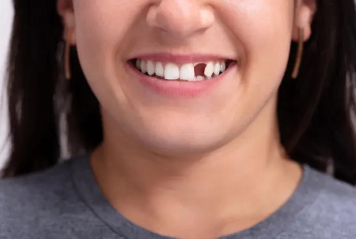 Estetska stomatologija podrazumeva jedan veći niz stomatoloških procedura i intervencija %%sep Cilj nam je pružanje oralnog zdravlja pacijentu!